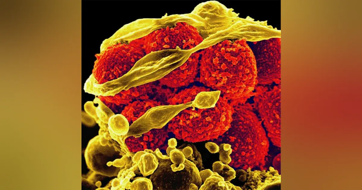 Underutilize Doctors underutilize next-gen antibiotics to fight resistant infections ...