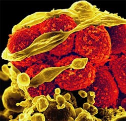 Scanning electron micrograph of methicillin-resistant Staphylococcus aureus bacteria (red, round items) killing and escaping from a human white blood cell. NIAID.
