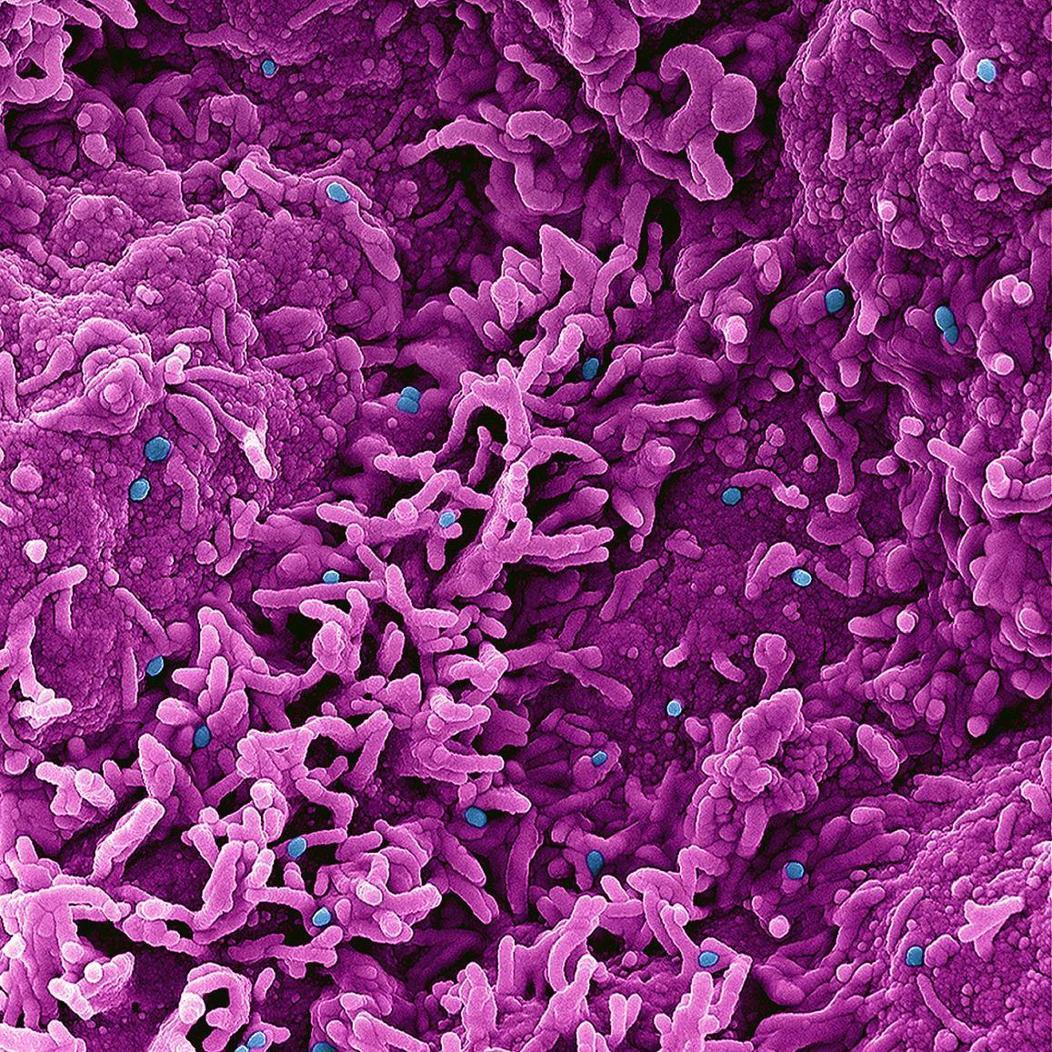 Colorized scanning electron micrograph of mpox virus particles (blue) on the surface of infected VERO E6 cells (pink). NIAID.