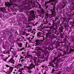 Colorized scanning electron micrograph of mpox virus particles (blue) on the surface of infected VERO E6 cells (pink). NIAID.