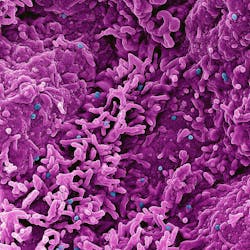 Colorized scanning electron micrograph of mpox virus particles (blue) on the surface of infected VERO E6 cells (pink). NIAID. Colorized scanning electron micrograph of mpox virus particles (blue) on the surface of infected VERO E6 cells (pink). NIAID.