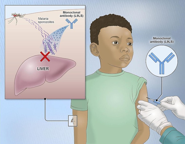 The experimental monoclonal antibody binds to and neutralizes “sporozoites,” the form of the malaria parasite transmitted by mosquitoes that invades the liver to initiate infection. NIAID.