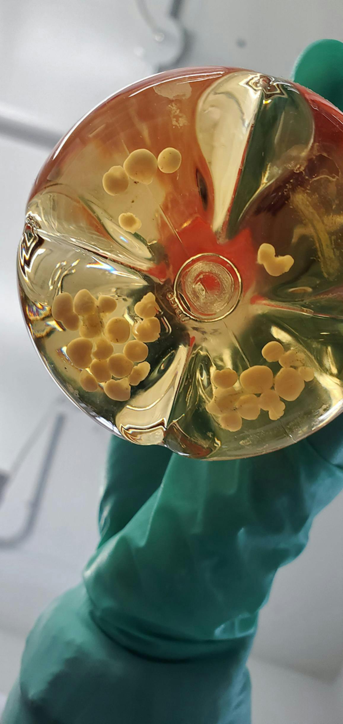 A researcher holds a flask containing human cerebral organoids similar to those used in the CWD study. NIAID.