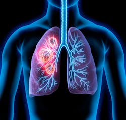 Courtesy of Qlucore Courtesy of Qlucore