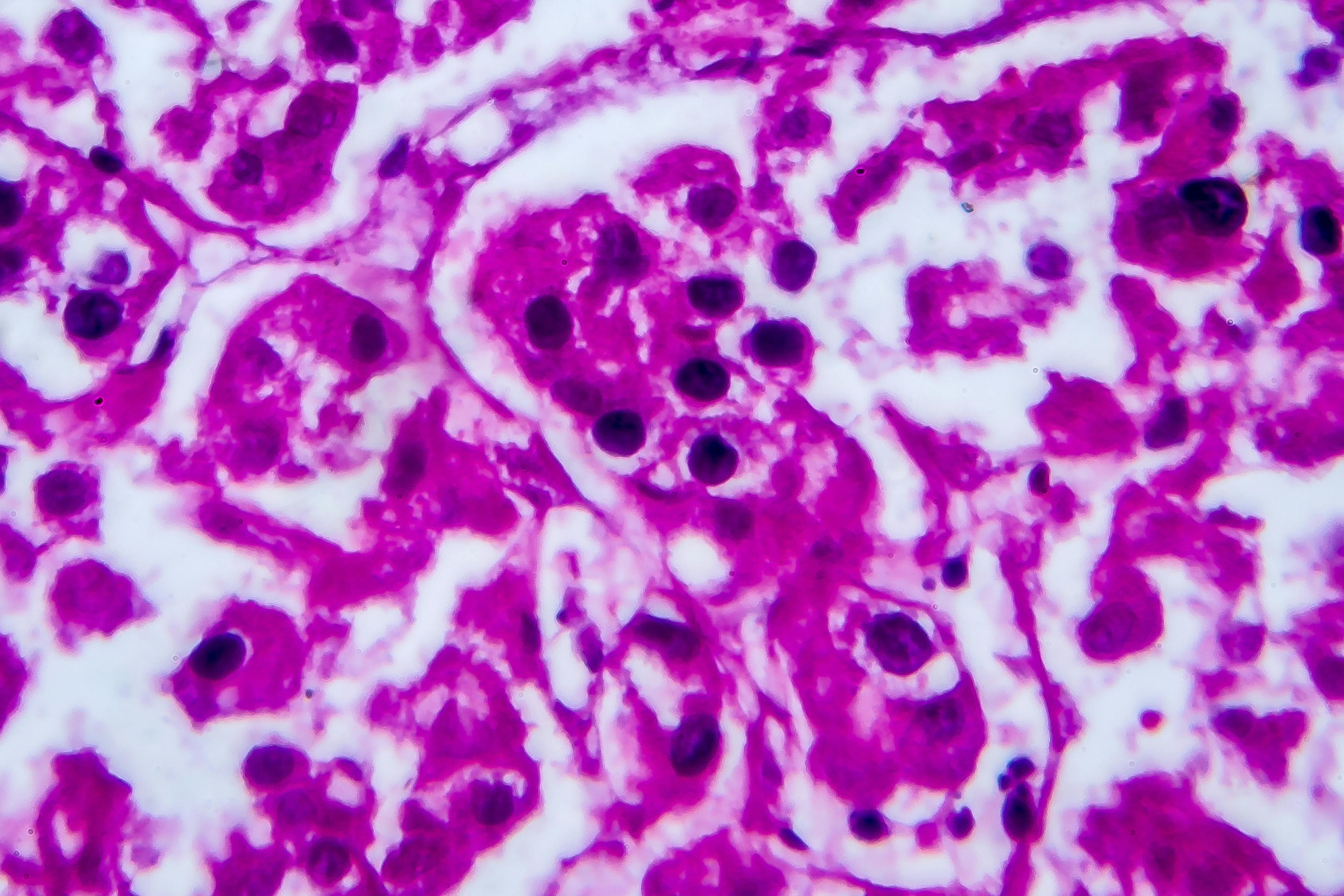 665f3123594a0fe8dfcecb06 Dreamstime Xxl 161611203