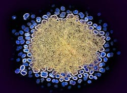 Colorized transmission electron micrograph of numerous HIV-1 virus particles (blue) replicating from a segment of a chronically infected H9 T cell (gold). NIAID. Colorized transmission electron micrograph of numerous HIV-1 virus particles (blue) replicating from a segment of a chronically infected H9 T cell (gold). NIAID.