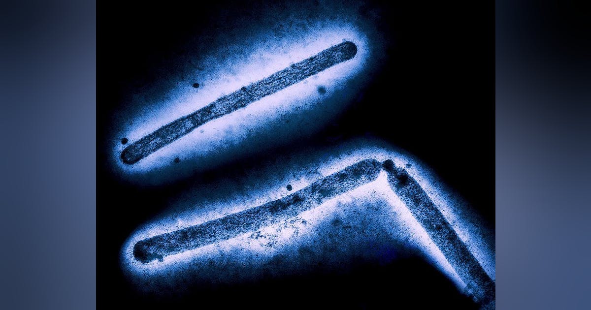 NIH releases H5N1 influenza research agenda Medical Laboratory Observer