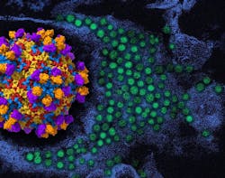 On the left is a 3D rendering of enterovirus D68 (viral proteins red, yellow, blue) with human monoclonal antibody EV68-228 (orange/purple). To the right in the background is a colorized transmission electron micrograph of enterovirus D68 virus particles (green). 3D rendering by NIAID; micrograph, repositioned and recolored by NIAID, courtesy of CDC. On the left is a 3D rendering of enterovirus D68 (viral proteins red, yellow, blue) with human monoclonal antibody EV68-228 (orange/purple). To the right in the background is a colorized transmission electron micrograph of enterovirus D68 virus particles (green). 3D rendering by NIAID; micrograph, repositioned and recolored by NIAID, courtesy of CDC.