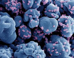 Colorized scanning electron micrograph of a cell (blue) infected with the Omicron strain of SARS-CoV-2 virus particles (pink), isolated from a patient sample. Image captured at the NIAID Integrated Research Facility (IRF) in Fort Detrick, Maryland. NIAID.