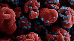 Colorized scanning electron micrograph of a cell (red) infected with SARS-CoV-2 virus particles (blue), isolated from a patient sample. NIAID.