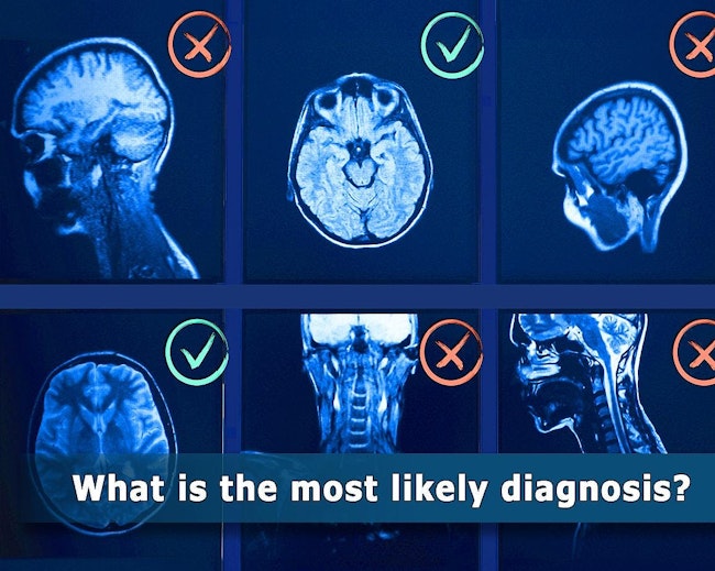 GPT-4V, an AI model, often made mistakes when describing the medical image and explaining its reasoning behind the diagnosis—even in cases where it made the correct final choice. NIH/NLM.