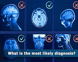 GPT-4V, an AI model, often made mistakes when describing the medical image and explaining its reasoning behind the diagnosis—even in cases where it made the correct final choice. NIH/NLM. GPT-4V, an AI model, often made mistakes when describing the medical image and explaining its reasoning behind the diagnosis—even in cases where it made the correct final choice. NIH/NLM.