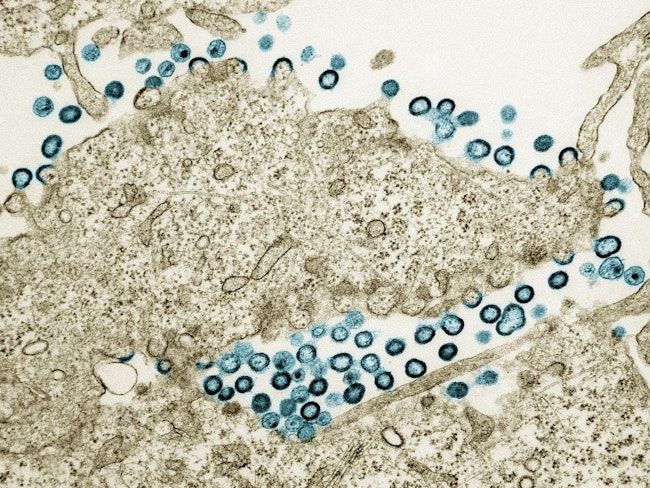 Transmission electron micrograph of HIV-1 virus particles (teal) budding and replicating from a segment of a chronically infected H9 cell (tan). Image captured at the NIAID Integrated Research Facility in Fort Detrick, Maryland. NIAID.