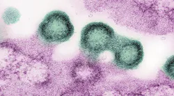 Transmission electron micrograph of HIV-1 virus particles (green) replicating from the plasma membrane of an H9 T cell (pink). NIAID.