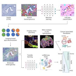 This graphic depicts a novel computational pipeline developed by Johns Hopkins Kimmel Cancer Researchers to identify early molecular and cellular progression to pancreatic ductal adenocarcinoma. Credit: Johns Hopkins Kimmel Cancer Center This graphic depicts a novel computational pipeline developed by Johns Hopkins Kimmel Cancer Researchers to identify early molecular and cellular progression to pancreatic ductal adenocarcinoma. Credit: Johns Hopkins Kimmel Cancer Center