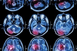 66d8626f1908fe8855135af8 Dreamstime Xxl 58960441 66d8626f1908fe8855135af8 Dreamstime Xxl 58960441