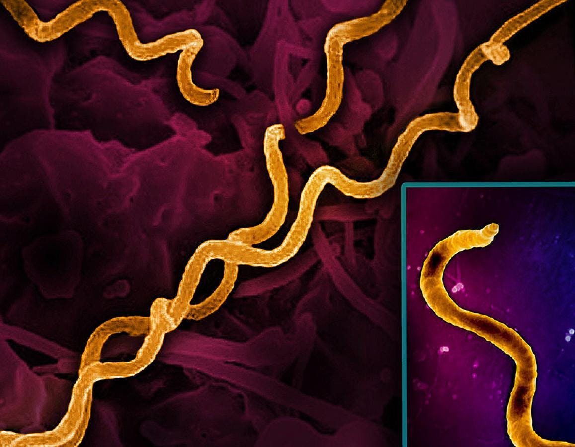 Electron micrograph imagery of Treponema pallidum, the bacteria that cause syphilis, including a foreground close-up of a single particle (right). Spiral-shaped bacteria are colorized in gold. NIAID.