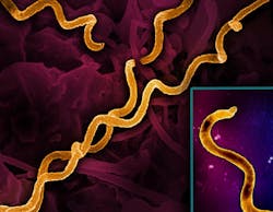 Electron micrograph imagery of Treponema pallidum, the bacteria that cause syphilis, including a foreground close-up of a single particle (right). Spiral-shaped bacteria are colorized in gold. NIAID. Electron micrograph imagery of Treponema pallidum, the bacteria that cause syphilis, including a foreground close-up of a single particle (right). Spiral-shaped bacteria are colorized in gold. NIAID.