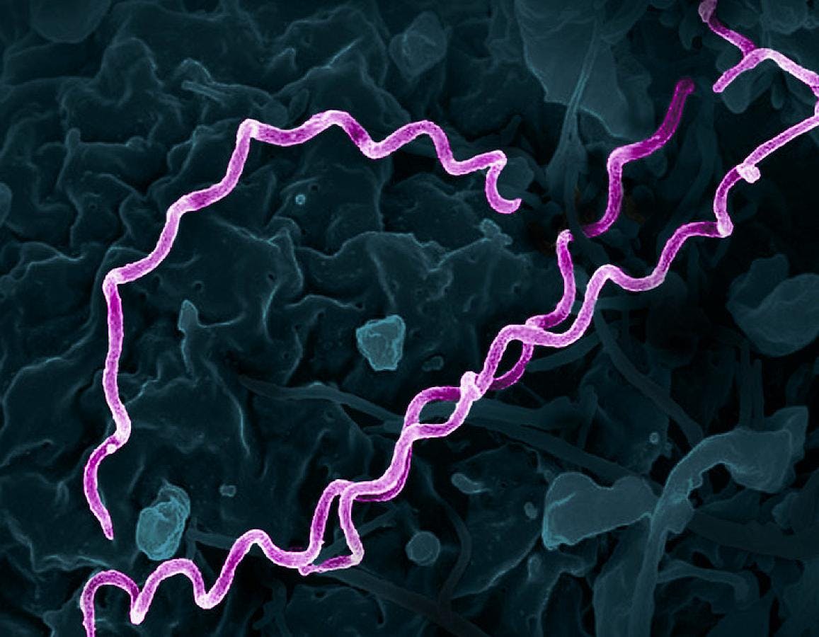 Colorized electron micrograph of Treponema pallidum, the bacteria that cause syphilis. Several spiral-shaped bacteria have been highlighted in pink. NIAID.