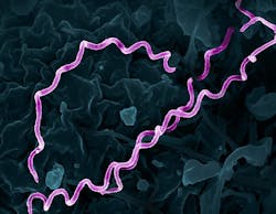 Colorized electron micrograph of Treponema pallidum, the bacteria that cause syphilis. Several spiral-shaped bacteria have been highlighted in pink. NIAID. Colorized electron micrograph of Treponema pallidum, the bacteria that cause syphilis. Several spiral-shaped bacteria have been highlighted in pink. NIAID.