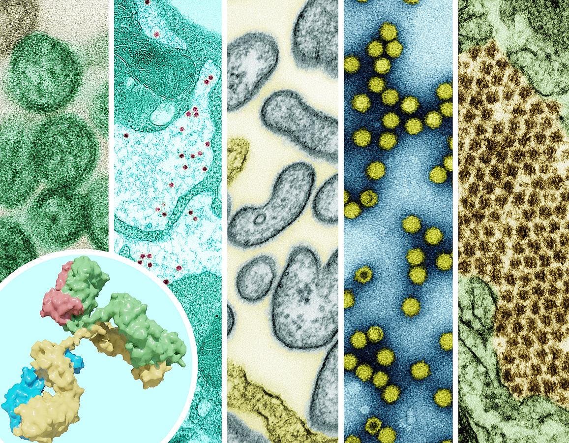 The ReVAMPP network will support monoclonal antibody and vaccine research on pathogens from many different groups of viruses, including those shown here: hantavirus, yellow fever virus, Nipah virus, picornavirus, and Chikungunya. NIAID.