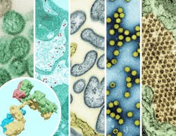 The ReVAMPP network will support monoclonal antibody and vaccine research on pathogens from many different groups of viruses, including those shown here: hantavirus, yellow fever virus, Nipah virus, picornavirus, and Chikungunya. NIAID. The ReVAMPP network will support monoclonal antibody and vaccine research on pathogens from many different groups of viruses, including those shown here: hantavirus, yellow fever virus, Nipah virus, picornavirus, and Chikungunya. NIAID.