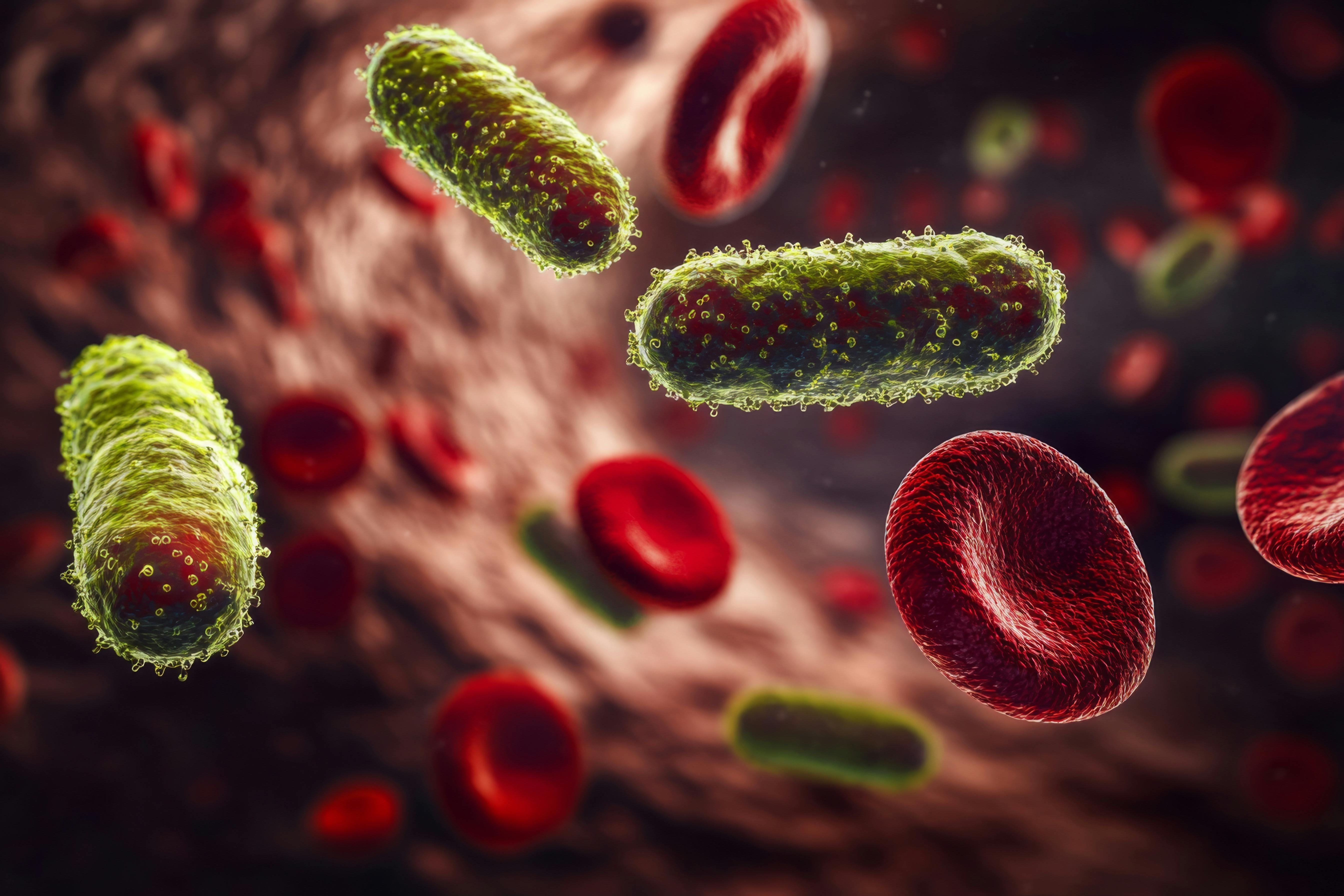 dreamstime_xxl_336482989