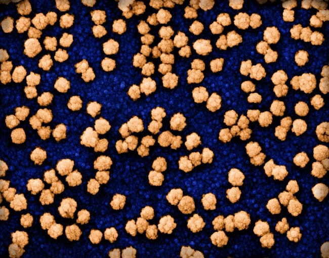 Colorized scanning electron micrograph of SARS-COV-2 particles (orange) on and budding from the surface of a heavily infected VERO E6 cell (blue). Image captured at the NIAID Integrated Research Facility (IRF) in Fort Detrick, Maryland. NIAID.