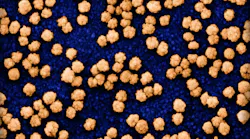 Colorized scanning electron micrograph of SARS-COV-2 particles (orange) on and budding from the surface of a heavily infected VERO E6 cell (blue). Image captured at the NIAID Integrated Research Facility (IRF) in Fort Detrick, Maryland. NIAID.