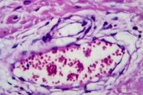 dreamstime_xxl_161604768 dreamstime_xxl_161604768