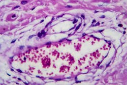 67102f21d7b30451b5170067 Dreamstime Xxl 161604768 67102f21d7b30451b5170067 Dreamstime Xxl 161604768