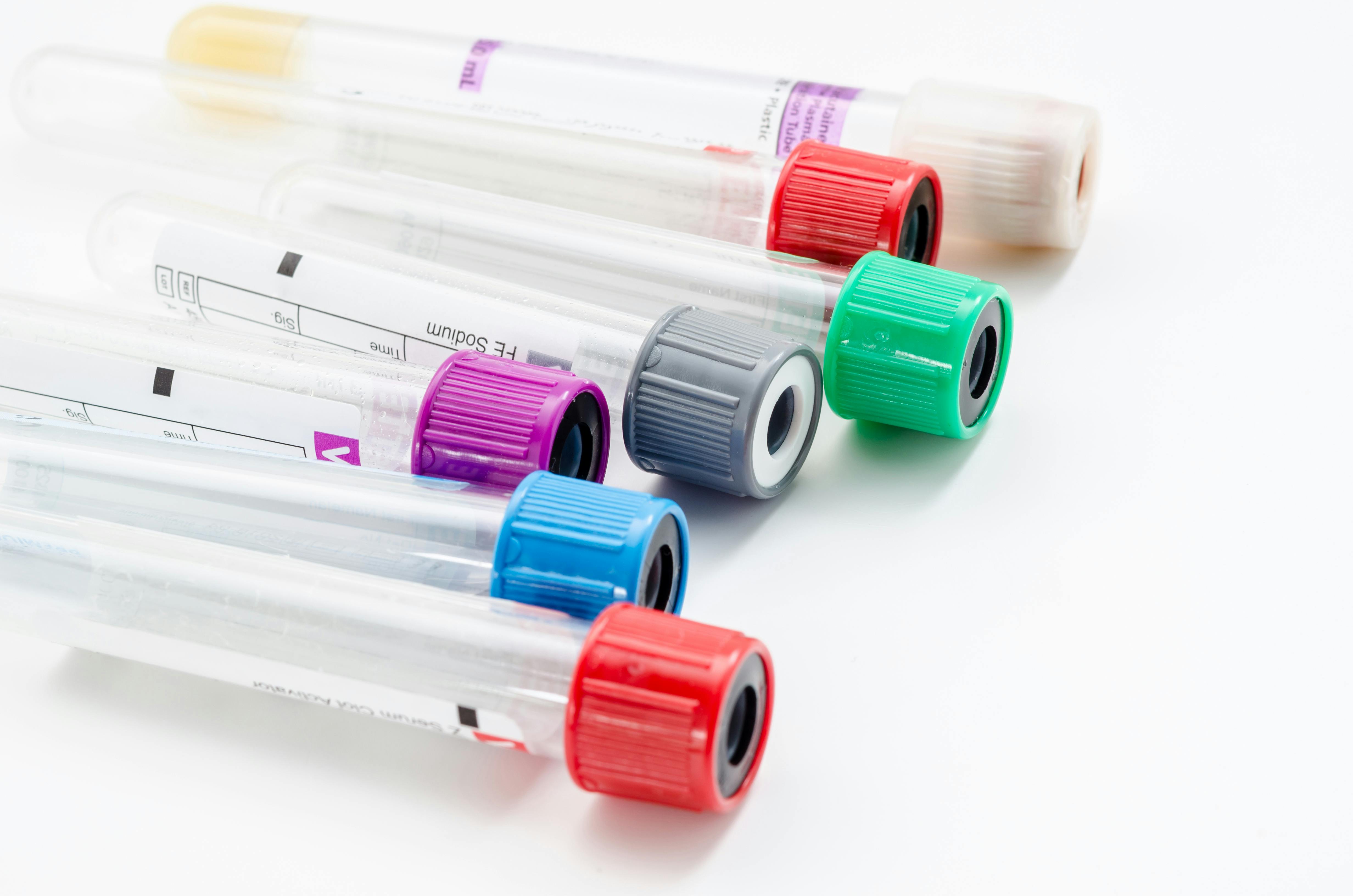 671263e7fa14481e2f61ef43 Dreamstime Xxl 61499797