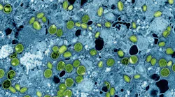 20241016mpoxvirus