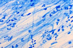 67224280e709c4772f06c52c Dreamstime Xxl 174325726 67224280e709c4772f06c52c Dreamstime Xxl 174325726