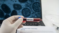 673b66e5c8b114330711f735 Dreamstime Xxl 330744468 673b66e5c8b114330711f735 Dreamstime Xxl 330744468