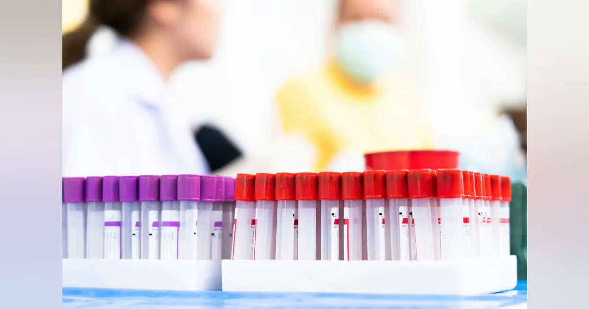 Predicting cardiac issues in cancer survivors using a serum protein ...