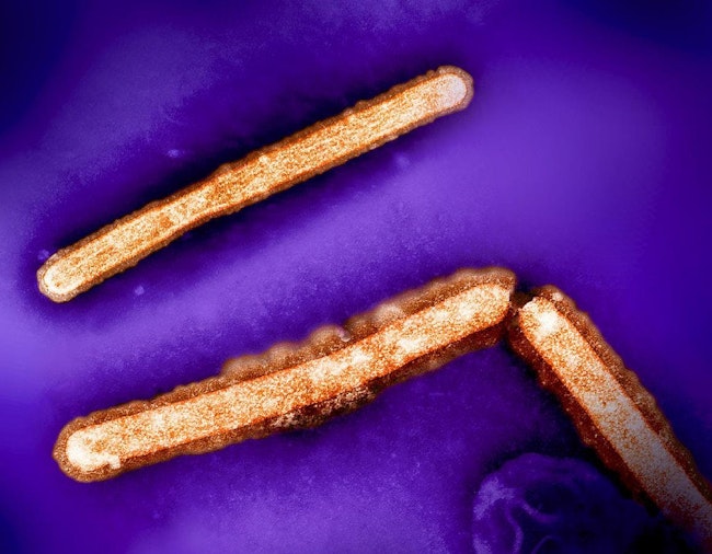 H5N1 avian influenza particles (rod-shaped; orange) NIAID and CDC.