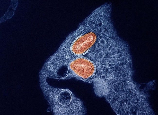 Colorized transmission electron micrograph of two particles of the virus that causes mpox, cultivated and purified from cell culture. NIAID.