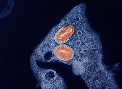 Colorized transmission electron micrograph of two particles of the virus that causes mpox, cultivated and purified from cell culture. NIAID. Colorized transmission electron micrograph of two particles of the virus that causes mpox, cultivated and purified from cell culture. NIAID.