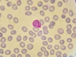 675b0132dcbe049b87b0e085 Dreamstime Xxl 99829496 675b0132dcbe049b87b0e085 Dreamstime Xxl 99829496