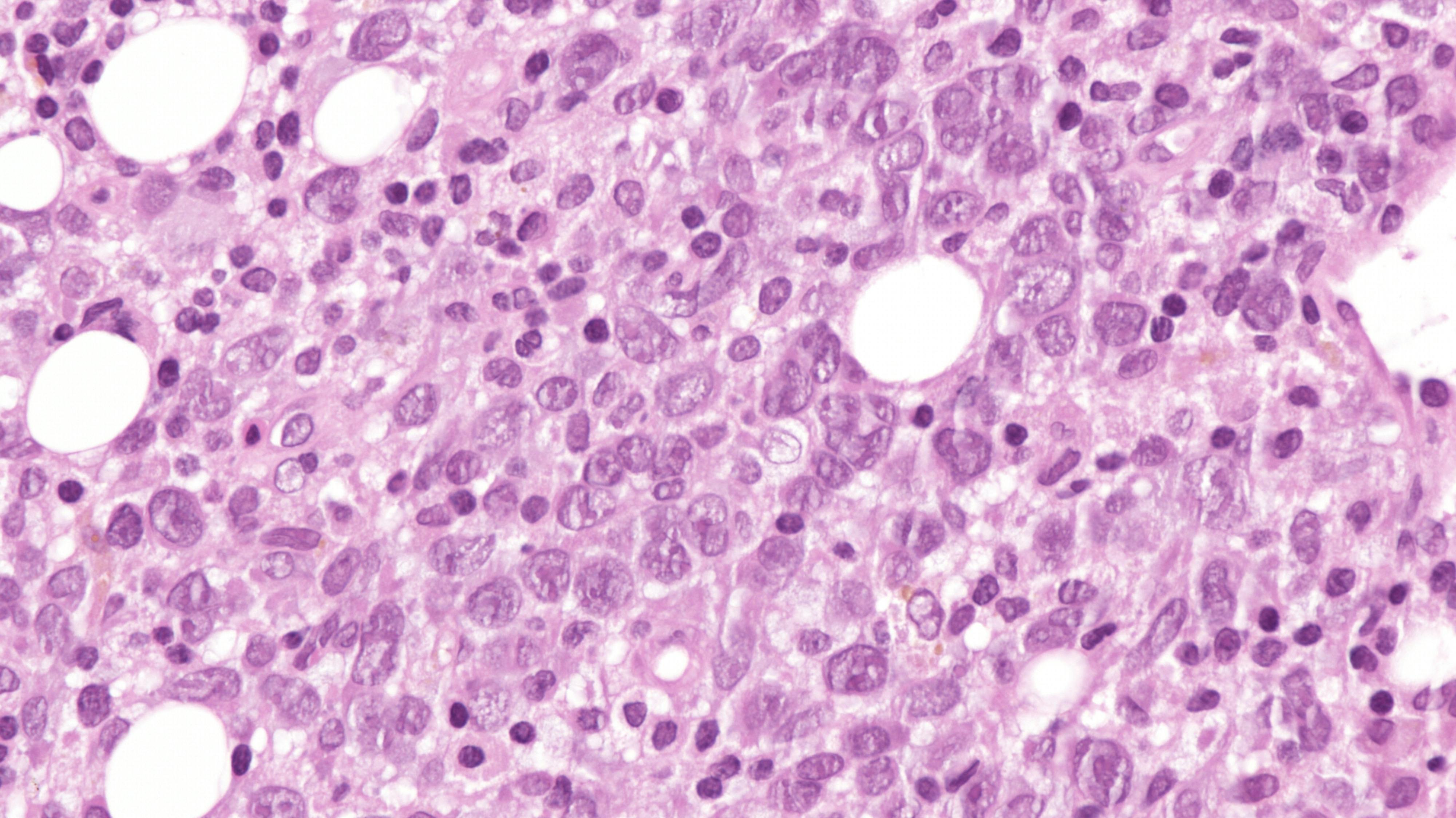 6786848cdcaecd8d5a3ecc52 Dreamstime Xxl 342822543