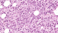 6786848cdcaecd8d5a3ecc52 Dreamstime Xxl 342822543 6786848cdcaecd8d5a3ecc52 Dreamstime Xxl 342822543