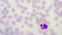 678925b89e95495de2ad1660 Dreamstime Xxl 66537811 678925b89e95495de2ad1660 Dreamstime Xxl 66537811