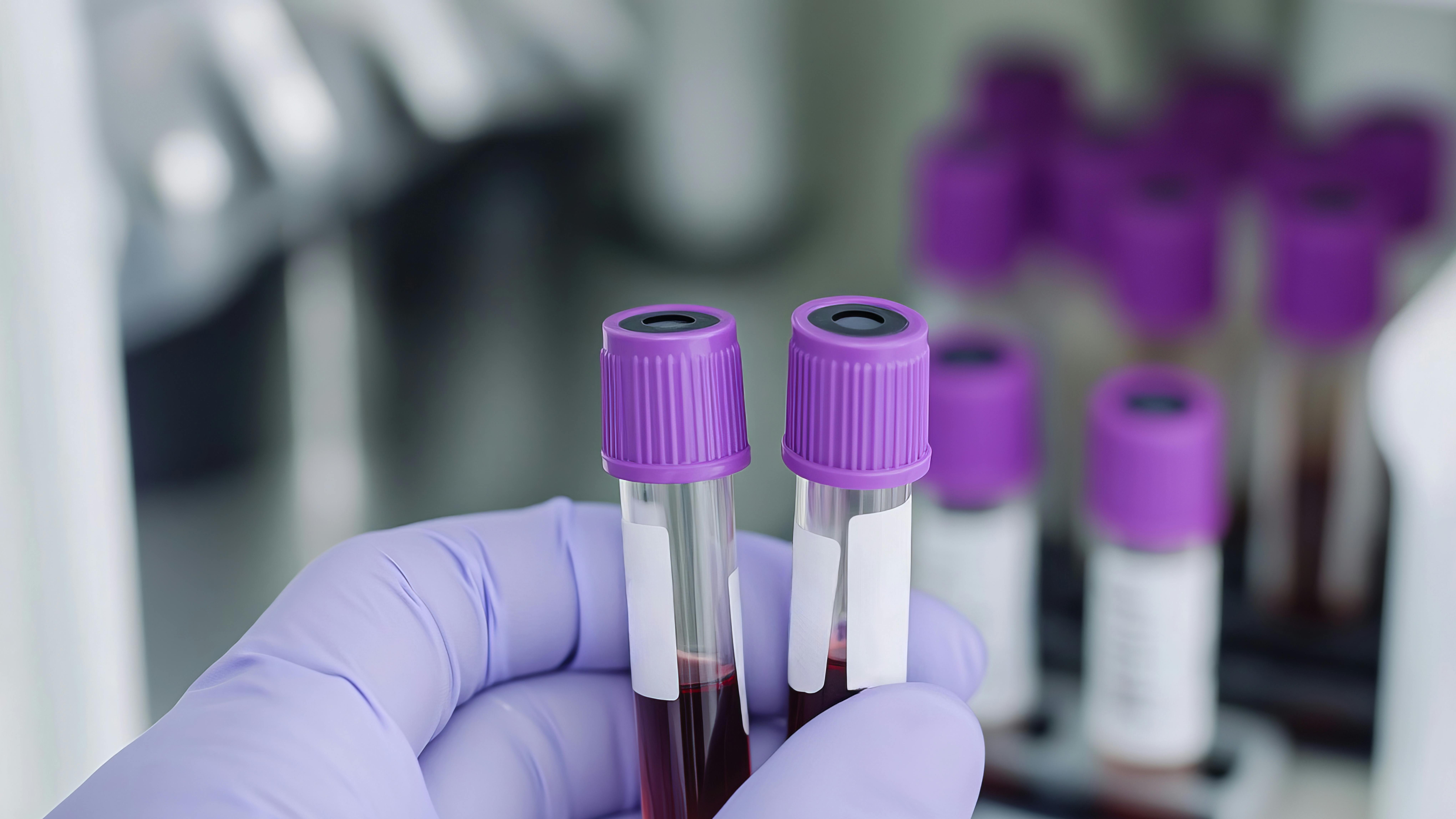 67b89d7ed830814bb50f7aff Adobestock 987739607