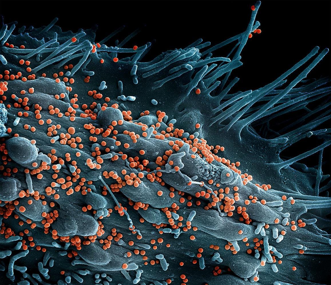 Scanning electron micrograph of Lassa virus budding off a cell. Lassa virus (LASV) is an arenavirus that causes Lassa hemorrhagic fever, a type of viral hemorrhagic fever (VHF) in humans and other primates. NIAID.