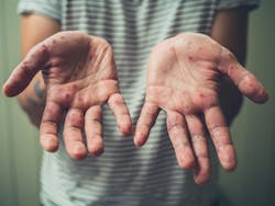 67dc299b655e95aefd112f22 Adobestock 176862638 67dc299b655e95aefd112f22 Adobestock 176862638