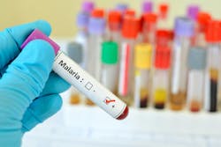 67ed42fdaa29de5fa700cef1 Adobestock 85499460 67ed42fdaa29de5fa700cef1 Adobestock 85499460