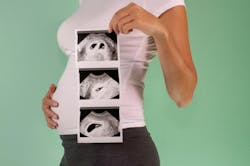 67fe6c150a68d20a64f5f787 Dreamstime Xxl 158531925 67fe6c150a68d20a64f5f787 Dreamstime Xxl 158531925