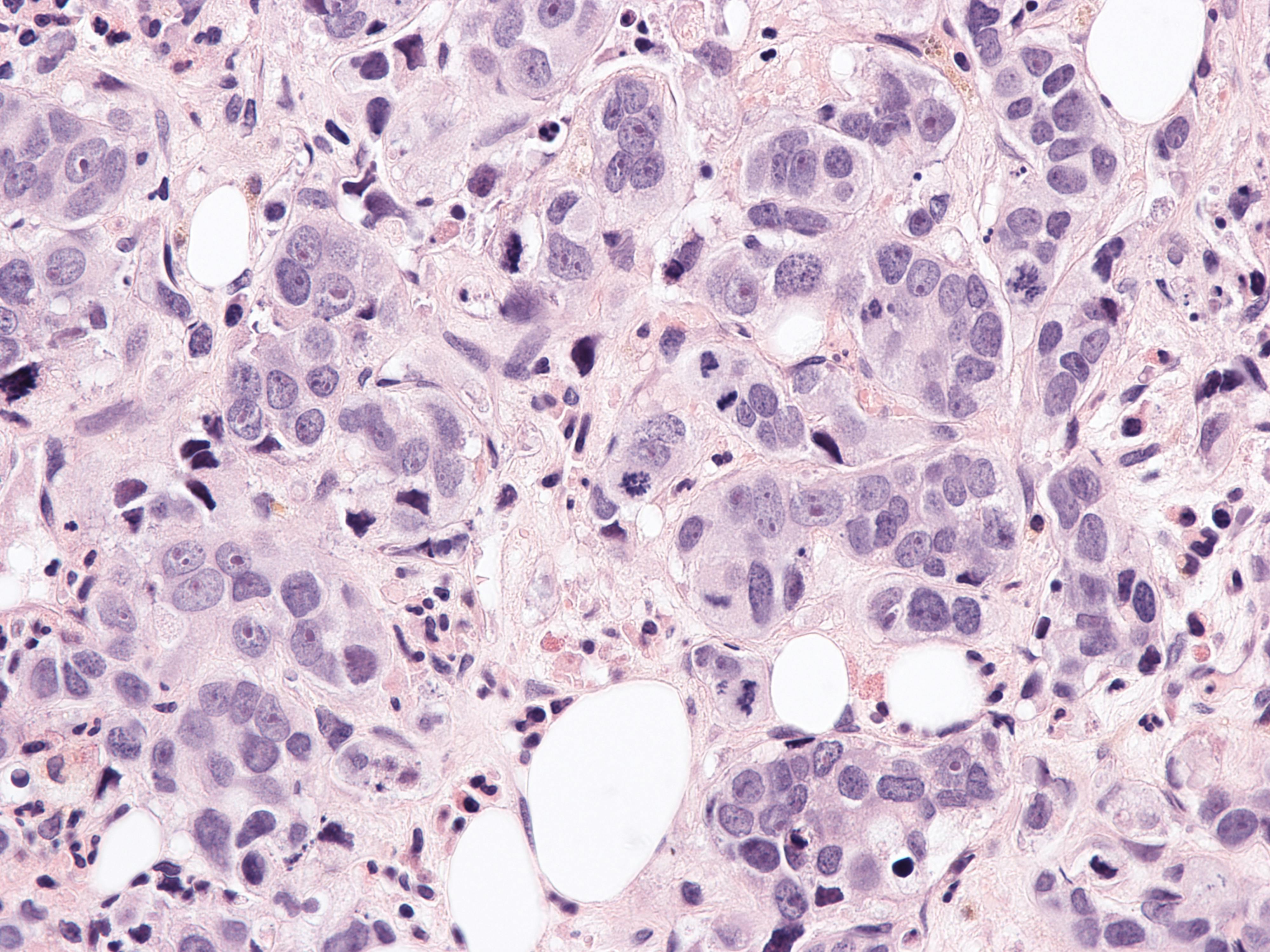 681230f37553f27578eb073f Dreamstime Xxl 282992682