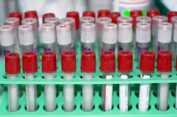 6824ab24c58d3d74e7fe66a0 Dreamstime Xxl 7990897 6824ab24c58d3d74e7fe66a0 Dreamstime Xxl 7990897